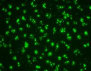 rnai figure4